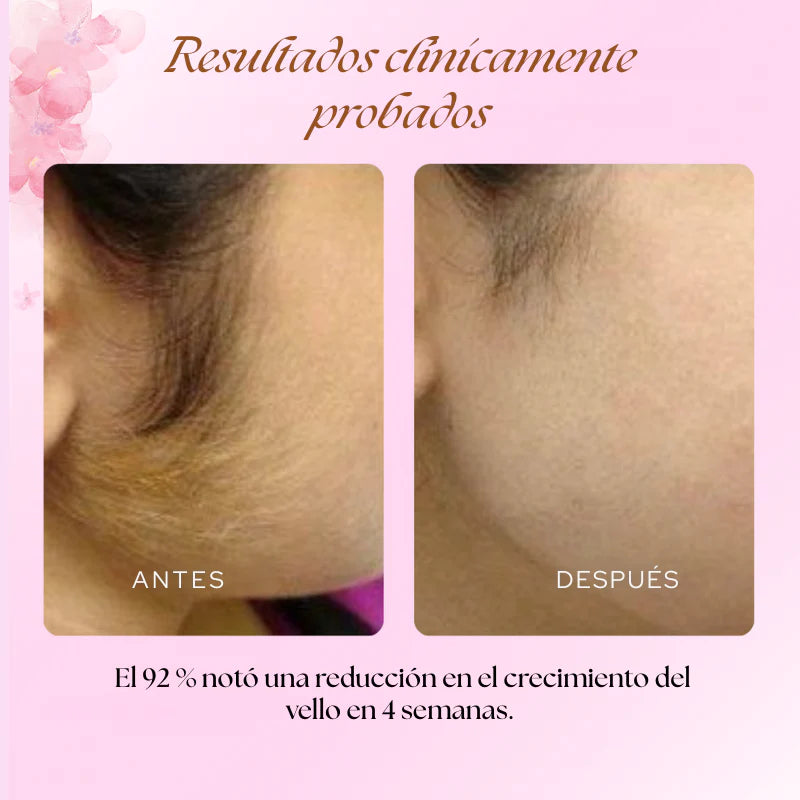 Cyperus Rotondus Oil - Reductor Crecimiento del Vello