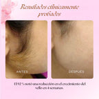 Cyperus Rotondus Oil - Reductor Crecimiento del Vello