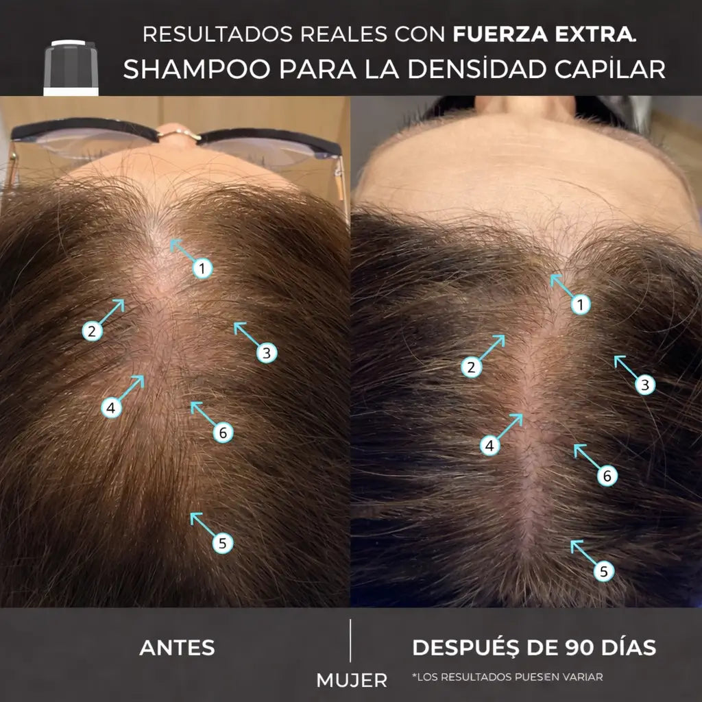 Revita Shampoo: Más volumen, movimiento, y limpieza ligera desde el lavado